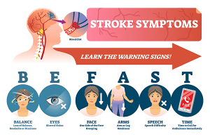 Stroke Symptoms